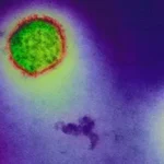 Hantavirus-infection_H.jpg
