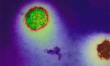 Hantavirus-infection_H.jpg